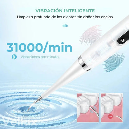 Cepillo Eléctrico Removedor de Sarro Dental